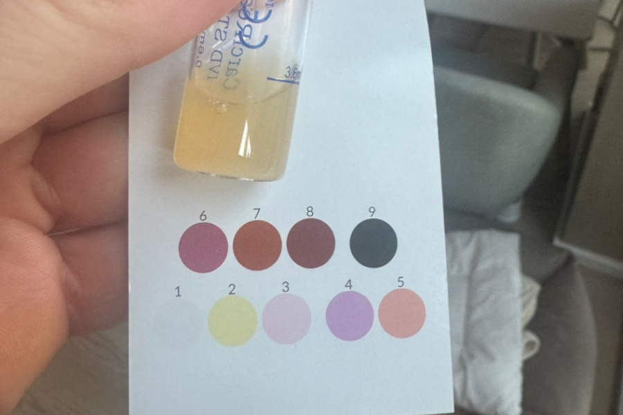 Carci Reagent Ergebnis mit Farbskala